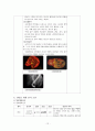 일반외과 담석 케이스 (A+) 12페이지