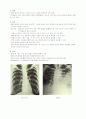 폐렴(Pneumonia) 2페이지
