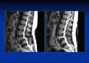 척추질환에 따른 영상의학 영상 8페이지
