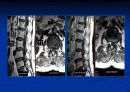 척추질환에 따른 영상의학 영상 40페이지