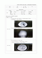 경막하혈종 케이스 스터디(SDH case study) 8페이지