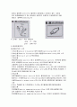 (간호학) 뇌동맥류환자 간호 aneurysm 2페이지