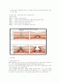 (간호) 무의식환자 간호 12페이지