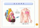 심근경색( Myocardial Infarction. MI ) CASE 4페이지