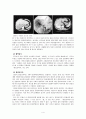 간세포암 - Hepatocellular carcinoma(HCC) case study 4페이지