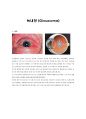 녹내장 (Glaucoma) 1페이지