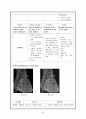 심근경색증(MI)case study 24페이지