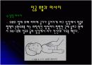 [아동교육] 부상과 응급처치 15페이지