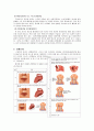 TONGUE CANCER(구강암)설암 csae study 8페이지