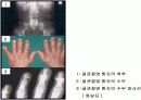   관절염의원리및항관절염성소재탐색과연구  34페이지