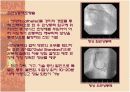 동맥경화의 원리 및 항동맥경화치료 16페이지