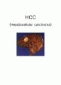 HCC (Hepatocellular carcinoma) 간세포암 케이스 1페이지