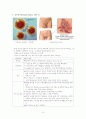 성 전파성 질환(성병) REPORT 10페이지