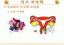 [여성학/성심리학] 피임에 관한 오해와 진실에 관한 편견과 과거와 현대 피임방법 소개 24페이지