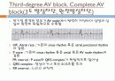 기본 심전도의 이해 33페이지