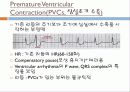 기본 심전도의 이해 34페이지