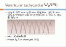 기본 심전도의 이해 38페이지