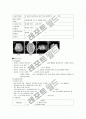 뇌경색(Cerebral Infarction)case study 4페이지