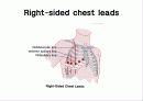 심전도[Electrocardiogram , ECG, 心電圖, EKG]  9페이지