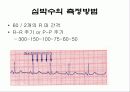 심전도[Electrocardiogram , ECG, 心電圖, EKG]  14페이지