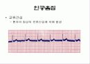 심전도[Electrocardiogram , ECG, 心電圖, EKG]  18페이지