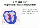 심전도[Electrocardiogram , ECG, 心電圖, EKG]  23페이지