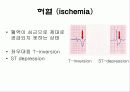 심전도[Electrocardiogram , ECG, 心電圖, EKG]  28페이지