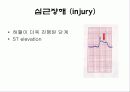 심전도[Electrocardiogram , ECG, 心電圖, EKG]  29페이지