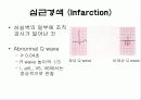 심전도[Electrocardiogram , ECG, 心電圖, EKG]  30페이지