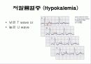 심전도[Electrocardiogram , ECG, 心電圖, EKG]  37페이지