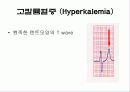 심전도[Electrocardiogram , ECG, 心電圖, EKG]  38페이지