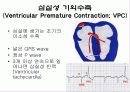 심전도[Electrocardiogram , ECG, 心電圖, EKG]  42페이지