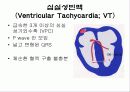 심전도[Electrocardiogram , ECG, 心電圖, EKG]  44페이지