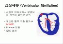 심전도[Electrocardiogram , ECG, 心電圖, EKG]  50페이지