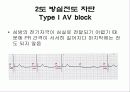심전도[Electrocardiogram , ECG, 心電圖, EKG]  54페이지