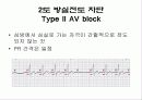 심전도[Electrocardiogram , ECG, 心電圖, EKG]  55페이지