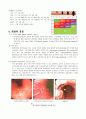 위암(Gastric cancer)에 관한 문헌고찰 및 병태생리 7페이지