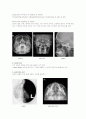 X-ray에 대해 2페이지
