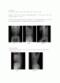 X-ray에 대해 6페이지