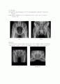 X-ray에 대해 8페이지