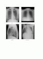 X-ray에 대해 10페이지