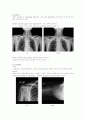 X-ray에 대해 11페이지