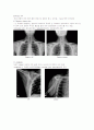 X-ray에 대해 12페이지