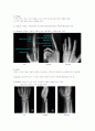 X-ray에 대해 15페이지
