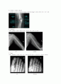 X-ray에 대해 18페이지