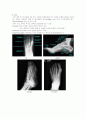 X-ray에 대해 19페이지
