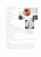 subarachnoid haemorrhage (SAH) 지주막하출혈 5페이지