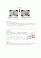 뇌출혈(Intra Cerebral Hemorrhage)case  9페이지