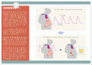 간호학과 pre eclampsia (자간전증) 간호과정 ppt 발표 A+★ 그림자료多 2페이지