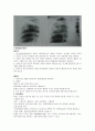 [간호학]폐결핵-Pulmonary Tuberculosis 4페이지